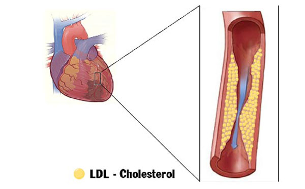 ba-bau-an-rau-dang-duoc-khong-thua-cholesterol-xo-vua-dong-mach