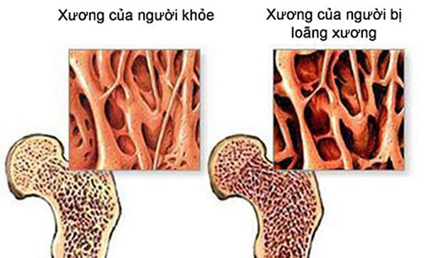 ba-bau-co-duoc-an-qua-thot-not-khong-bo-sung-photpho