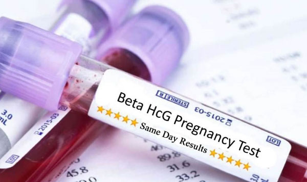 dau-hieu-mang-thai-ngoai-tu-cung-chi-so-hcg-giam