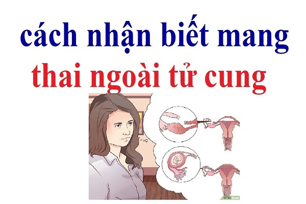 dau-hieu-mang-thai-ngoai-tu-cung