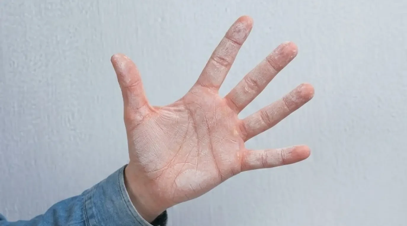 Bề mặt tường bị phấn hóa