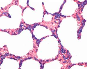 Gram-color Stain set for the Gram staining method