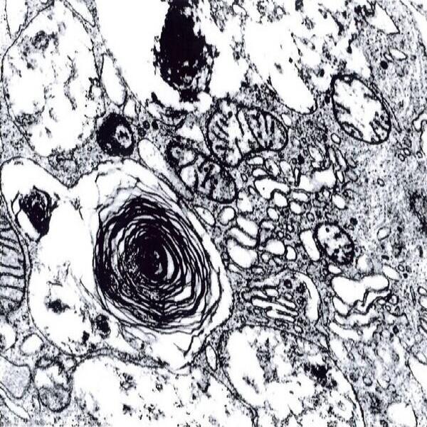 glutardialdehyde-solution-25-for-electron-microscopy-purified-and-filled-under-nitrogen-merck