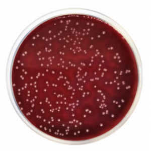 columbia-agar-base-for-the-cultivation-of-fastidious-microorganisms-according-harm-ep-usp-jp-and-iso