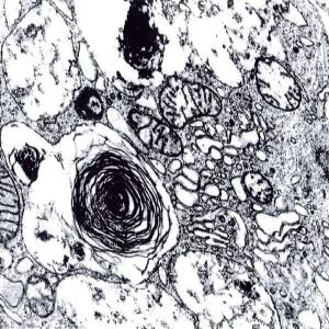 glutardialdehyde-solution-25-for-electron-microscopy-purified-and-filled-under-nitrogen-merck