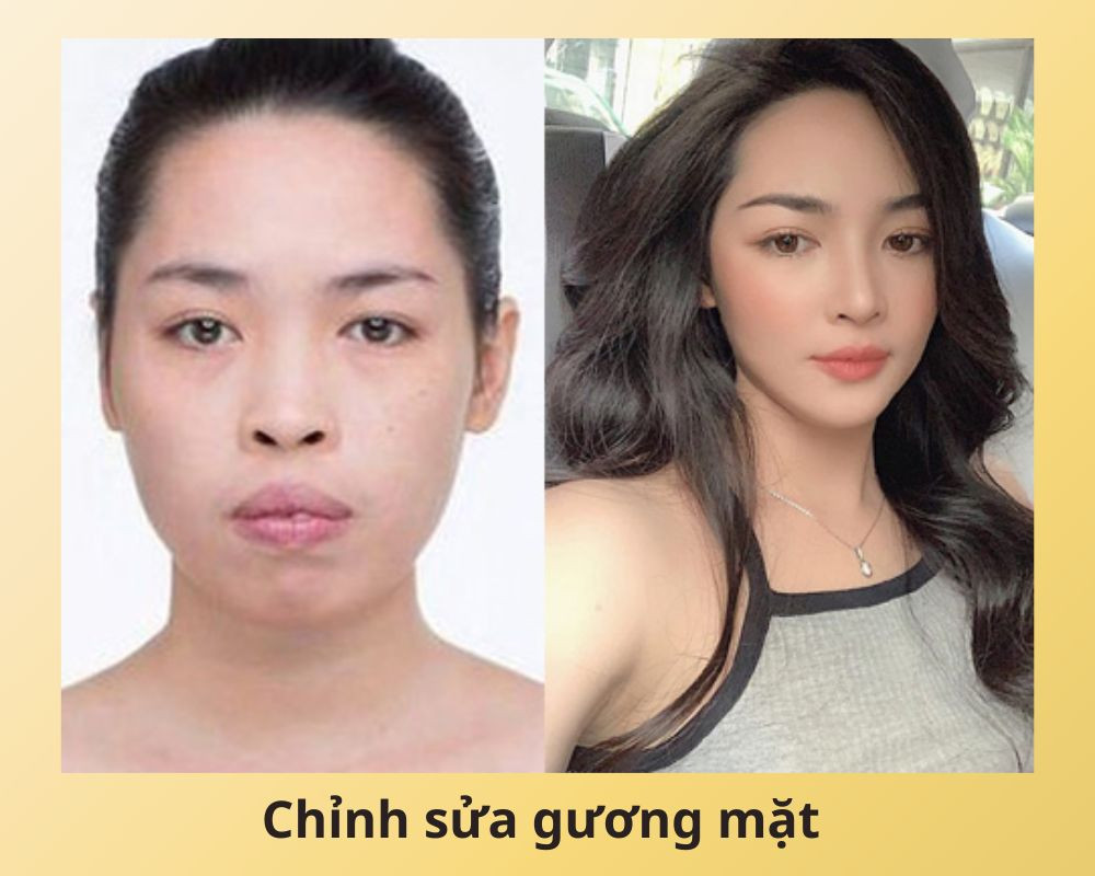 Thẩm mỹ gương mặt