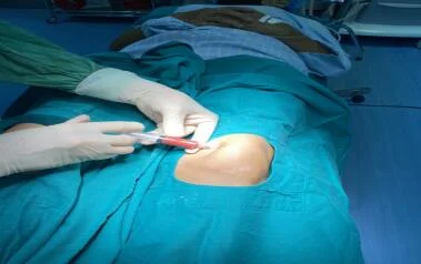 THÔNG BÁO VỀ VIỆC ĐĂNG KÝ ĐIỀU TRỊ BỆNH THOÁI HÓA KHỚP GỐI BẰNG CÔNG NGHỆ GHÉP TẾ BÀO GỐC TỰ THÂN