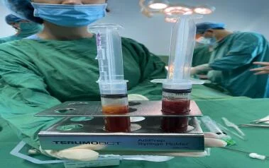 BỆNH VIỆN ĐẠI HỌC Y KHOA VINH TIẾP TỤC TRIỂN KHAI CÔNG NGHỆ GHÉP TẾ BÀO GỐC TỰ THÂN TRONG ĐIỀU TRỊ BỆNH THOÁI HÓA KHỚP GỐI