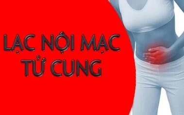 BỆNH LẠC NỘI MẠC TỬ CUNG