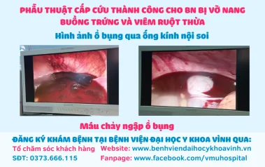 PHẪU THUẬT CẤP CỨU THÀNH CÔNG CHO BỆNH NHÂN BỊ VỠ NANG BUỒNG TRỨNG VÀ VIÊM RUỘT THỪA