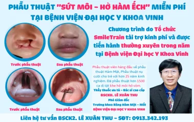 Chương trình phẫu thuật miễn phí cho trẻ bị dị tật khe hở môi - vòm miệng tại Bệnh viện Đại học Y khoa Vinh