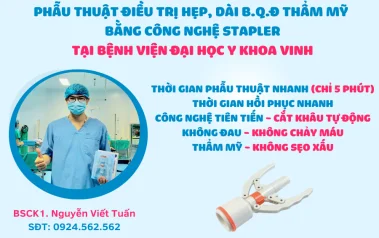 Phẫu thuật cắt BQĐ thẩm mỹ bằng máy Stapler tại bệnh viện ĐHYK Vinh