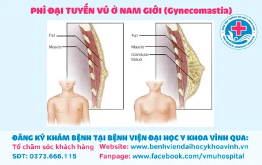 Phẫu thuật phì đại tuyến vú nam giới tại Bệnh viện Đại học Y khoa Vinh