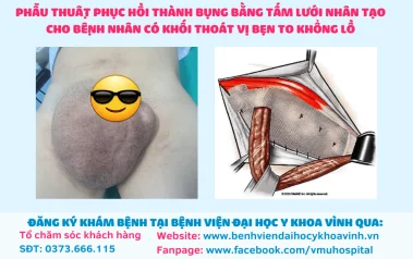 Phẫu thuật phục hồi thành bụng bằng tấm lưới nhân tạo cho bệnh nhân có khối thoát vị bẹn khổng lồ