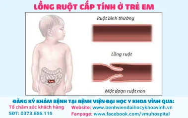 Lồng ruột cấp ở trẻ em: Triệu chứng, nguyên nhân, phương pháp chẩn đoán và điều trị