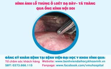 THỦNG Ổ LOÉT DẠ DÀY – TÁ TRÀNG DO LẠM DỤNG THUỐC CORTICOID