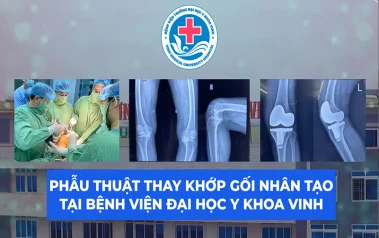 Phẫu thuật thay khớp gối thành công cho bệnh nhân bị đau, thoái hóa, biến dạng khớp gối nhiều năm
