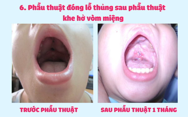 image-17