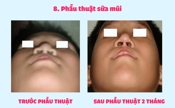 image-19