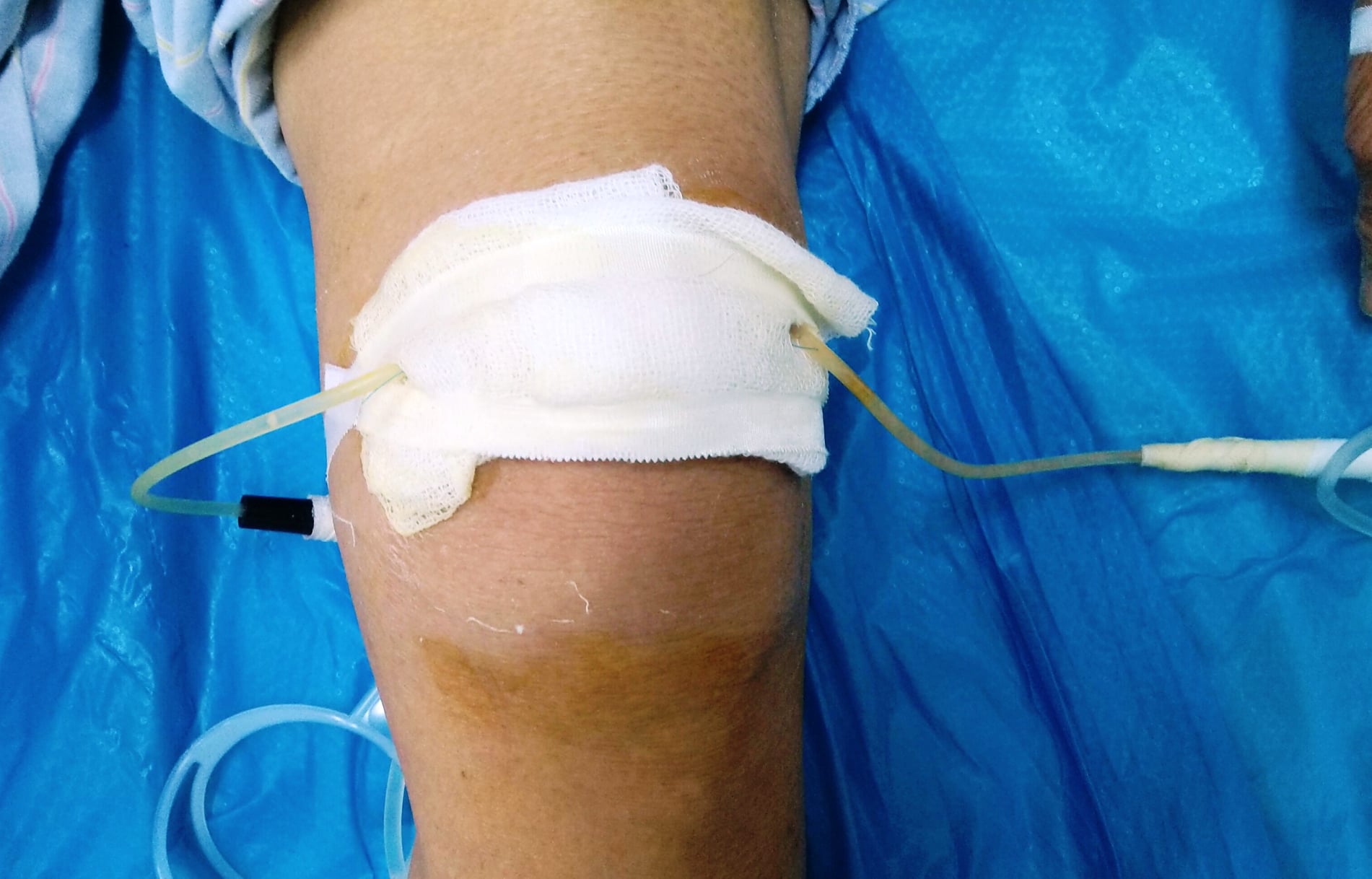 Sức khỏe của bạn: Bệnh khớp trong mùa lạnh - Bệnh viện đại học Y Khoa Vinh