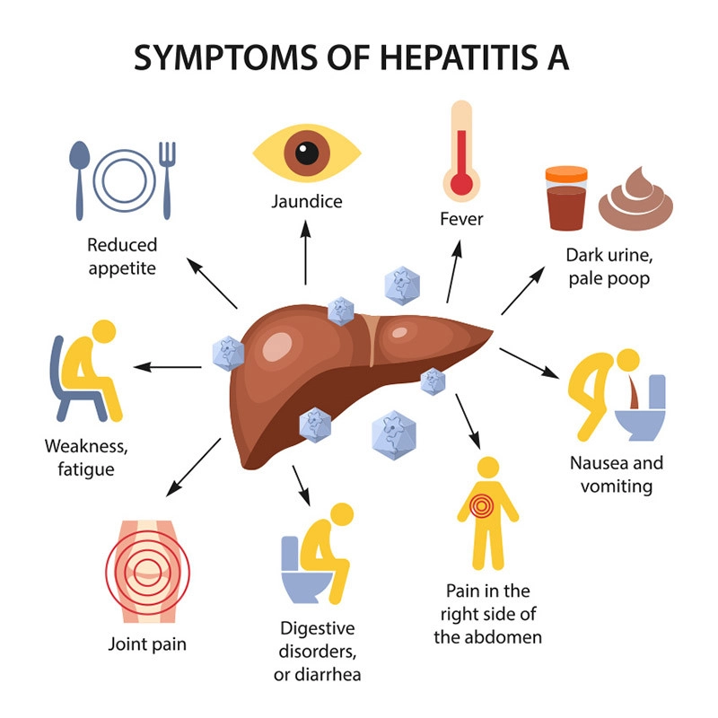 Hepatitis A