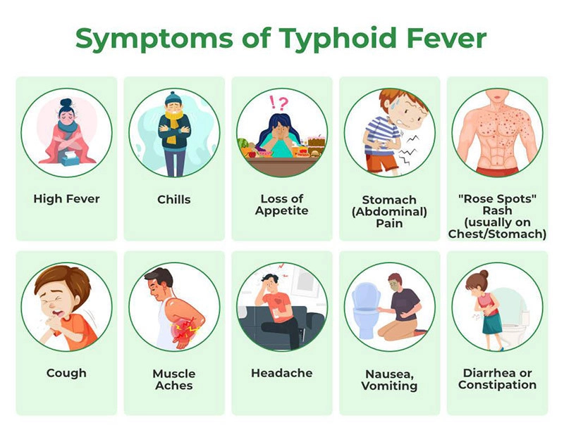 Typhoid fever