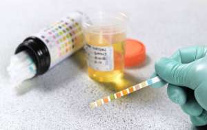 Ketone là gì? Vì sao nên thường xuyên xét nghiệm ketone?